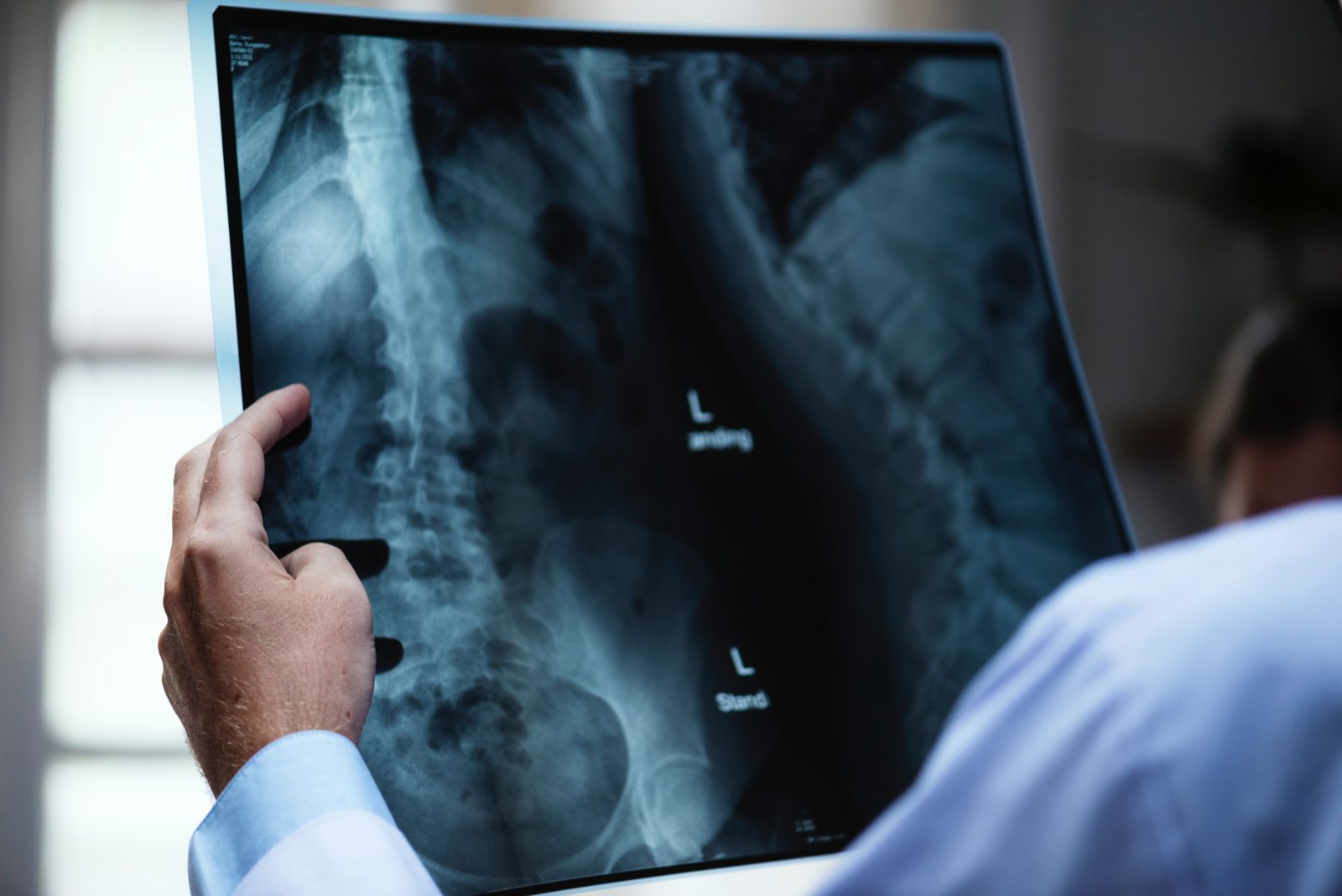 The Key Similarities and Differences Between Mesothelioma and Lung Cancer